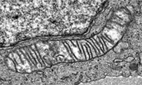 Mitochondria Electron Micrograph